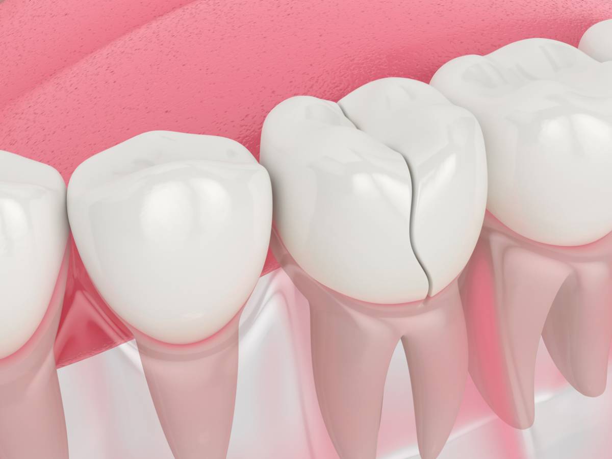 Can Your Tooth Repair Itself?  East Highland Dental Office - Blog