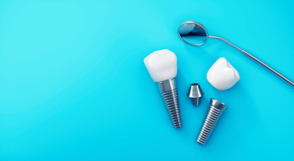 concept of dental implants