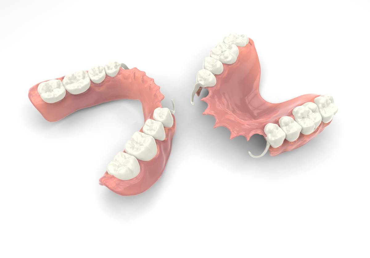 Featured image for What Is the Best Type of Denture?